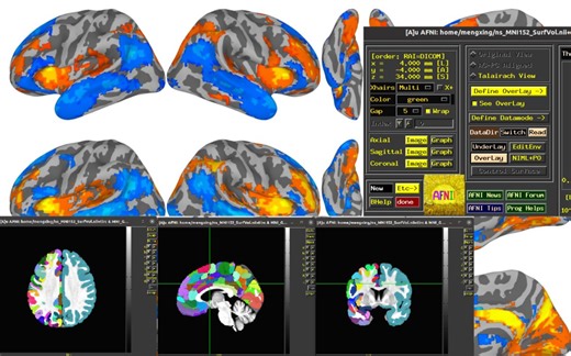 中文-神经成像软件AFNI基本操作系列教程00-前言