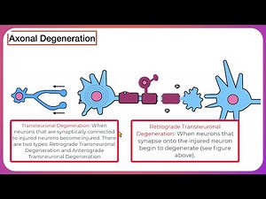 Axonal Degeneration