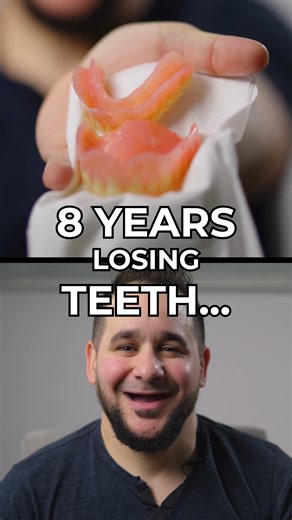 Life got in the way… and before he knew it, 8 years had passed. Every year without teeth can feel like another year lost. But here’s the truth: the years behind you don’t define what’s possible ahead. You deserve to eat, smile, and laugh without worry. Comment "want this" to get started ✅ #missingteeth #newsmile #SmileMakeover #SmileTransformation #DentalImplants | Nuvia Dental Implant Center