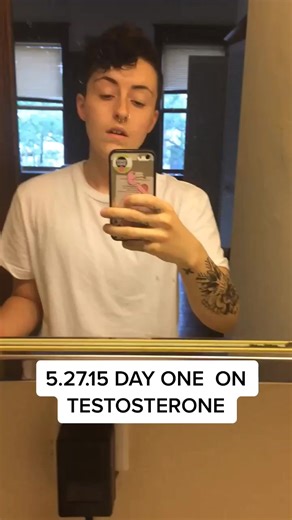 Mini timeline to see physically how hormones work for transmasc folks! BE PATIENT. Everyone is different. #fyp #lgbt #transgender #transitioning