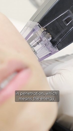 Listen in as Dr. Nitin, our renowned plastic, cosmetic, and reconstructive surgeon talks about the groundbreaking Morpheus8 - the Next-generation non-surgical skin treatment. Because Morpheus8 can improve so many skin problems, it’s an excellent treatment if you’re hoping to address more than one skin flaw. Book an appointment with us to learn more about morpheus8! #vlccuae #morpheus8 استمع إلى الدكتور نيتين، جراح التجميل والترميم المشهور، يتحدث عن علاج الجلد غير الجراحي الجيل التالي، Morpheus8.