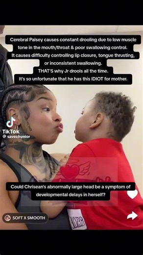 Cerebral Palsey causes constant drooling due to low muscle tone in the mouth/throat & poor swallowing control. It causes difficulty controlling lip closure, tongue thrusting, or inconsistent swallowing. THAT'S why Jr drools all the time. It's so unfortunate that he has this IDIOT for mother. #bluefacebleedem #chriseanrock #chriseanrockbabyy #iamnevaehakira #chrisean