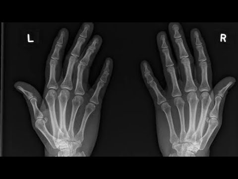 hand ball catcher postion topic no 4 in urdu