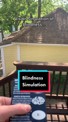Blindness Vision Simulation: Understanding Different Perspectives