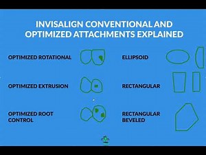 Turn that Clincheck from Turd to Treasure!- Optimized Vs Conventional Invisalign Attachments