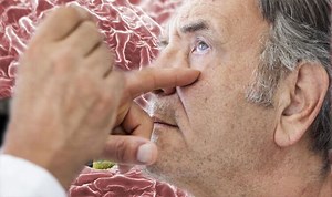 NHS: Expert gives advice on treatment of chlamydia