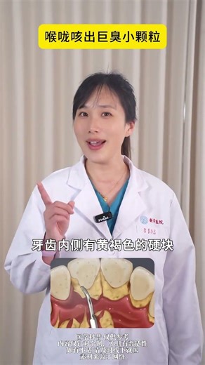 What's Behind the Gross: Unveiling the Mystery of Throat Gunk