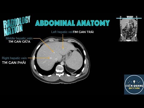 Giải Phẫu Ổ Bụng Đầy Đủ - Cắt Lớp Vi Tính CT Scanner