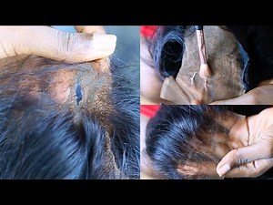 How To: Fast & Easy Fix A TORN Or RIPPED Lace Closure/Frontal Wig With Extra Tips Headmistress