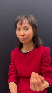 Awake Deep Plane Facelift - 1 months out