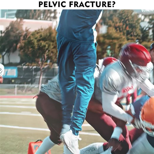 #tiktoktvfilmcontest | pelvic bone
