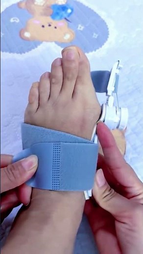 Top Adjustable Big Toe Straighteners for Correcting Toe Deformity at Home