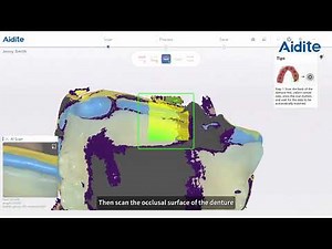 5 Aidite Rapid3 Intraoral Scanner: Removables Case Scan