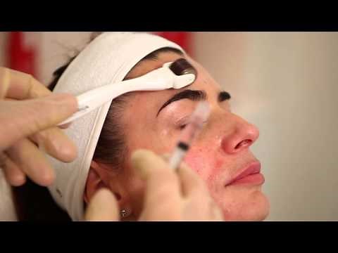 FILORGA - Bespoke NCTF 135 for Mesotherapy For Total Turnaround Results