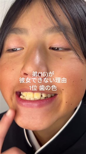 弟とホワイトニングシートの正直レビュー