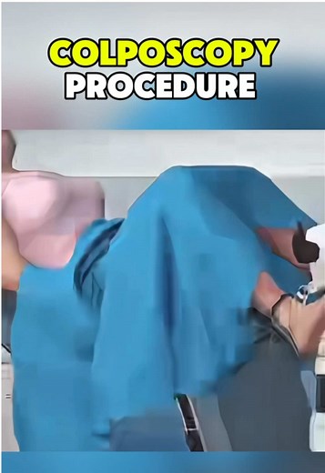 Understanding the Colposcopy Procedure: A Step-by-Step Guide