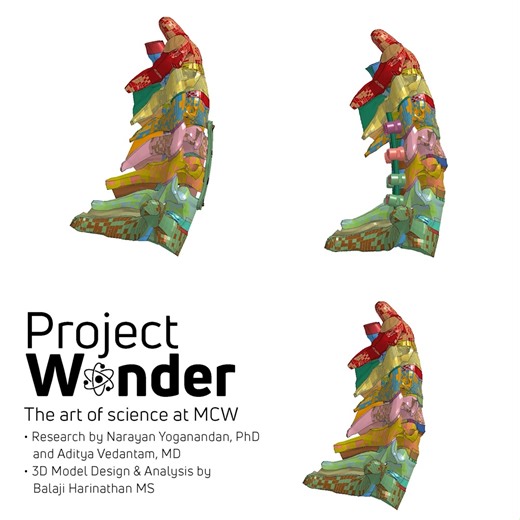 2K views · 16 reactions | What if spine surgeons could predict your...