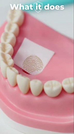 🦷 Membrane After a Tooth Extraction—What Is It and Why Is It Used?