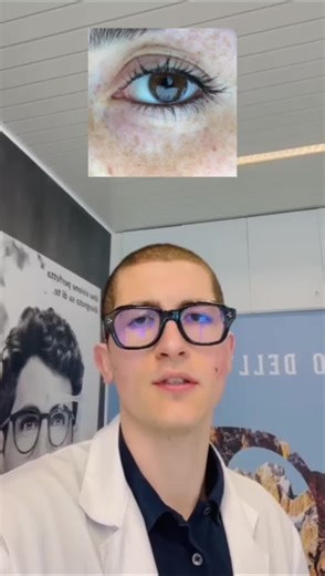 Miochimia: Cause e Curiosità sugli Occhi