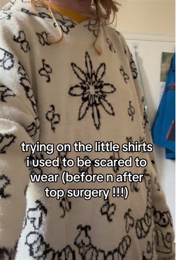 Transformation Journey: Trying on Shirts After Top Surgery