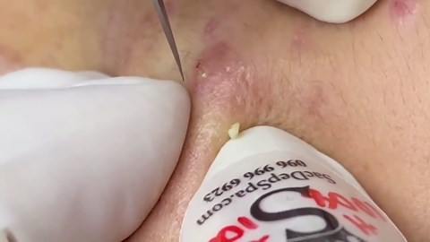 015 • Relax Spa • АСМР • Acne collection