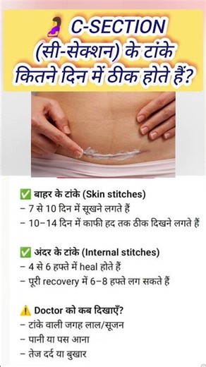 How many days does it take for C-section stitches to heal?