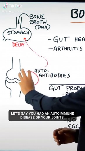How Bone Broth Helps With arthritis #drericberg #autoimmune #joints #bonebroth #arthritis
