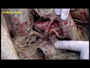 Celiac Trunk - Dissection • Video • MEDtube.net