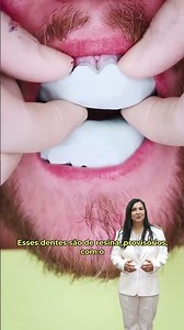 COM A UTILIZAÇÃO DE MOCKUP, O PACIENTE CONSEGUE VER REALMENTE COMO VAI FICAR O SORRISO FINAL