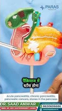 जाने सर्जिकल गैस्ट्रोएंटरोलॉजी की विशेषज्ञ जानकारी डॉ. साद अनवर से