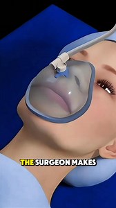 See how doctors fix thumb pain with Basal Joint Surgery! #basaljointsurgery #thumbpain #HandSurgery #medicalanimation #DoctorExplains | Dr. Elon Swift