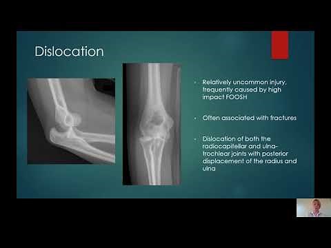 Elbow X ray interpretation in ED