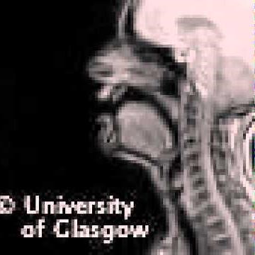 MRI voiced labio-dental approximant