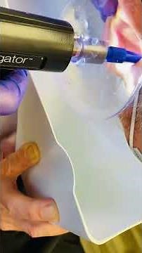 Ear Wax Removal using the Earigator. We’re at it again on Waxy Wednesdays!