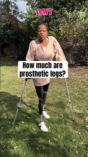 How much are prosthetic legs?