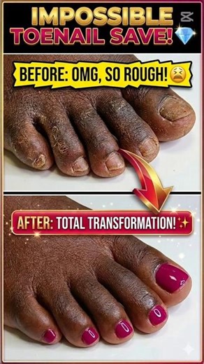 IMPOSSIBLE Toenail Save! 😱✨ (Transformation) classic red gel toenails appplication.