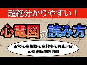 【一発理解！】心電図のわかりやすい読み方〜正常・心室細動・心室頻拍・心静止・PEA・心房細動・期外収縮〜