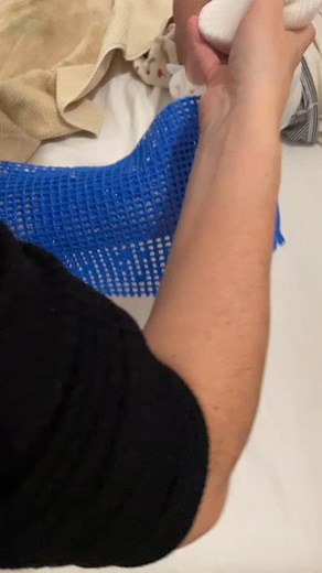 Nouvelle attelle de pied bot #kine #baby #physio #pediatrie #bebe #piedbot #pediatria | Kiné des bébés