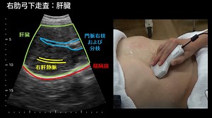 WiZの腹部エコーと手技06_右肋弓下走査(肝臓)