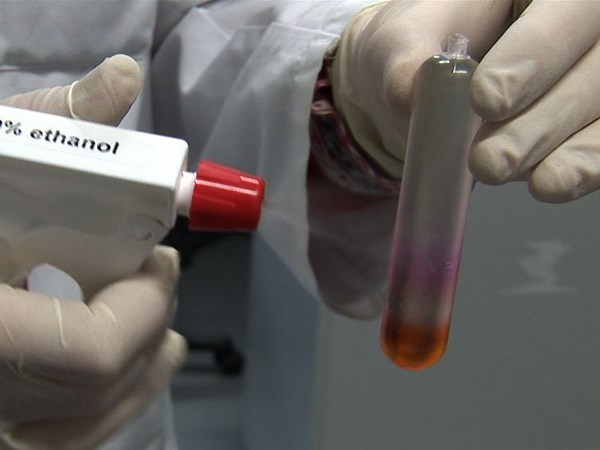 Engineering Synthetic AAV Gene Therapy | JoVE Journal