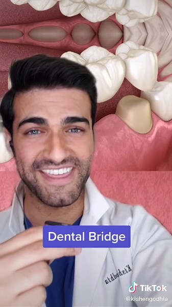 Building Bridges 101: Everything You Need to Know