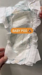 Should it be that colour? Is it the right texture? Find out what’s normal for your baby’s poo. 💩 | BabyCenter Australia