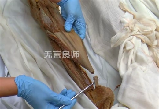 真实的人类左腿标本（腓肠肌和比目鱼肌介绍）