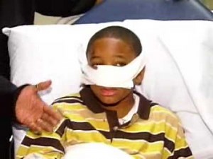 Dog Bites 11-Year-Old Boy In Face