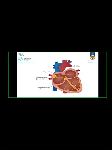 Fetal Tachyarrhythmia presentation: Case Report by Dr Mvundura. Head on over to our Youtube channel and watch the whole presentation. https://youtu.be/qFqNFHU5TAY