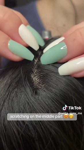 Satisfying Scalp Scratching for Dandruff Removal