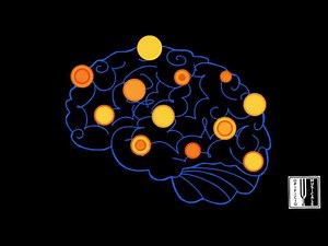 I Benefici della musica per il Cervello