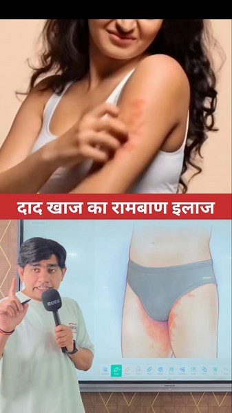 खुजली का रामबाण इलाज😱😱#facts #knowledge #health #information #awareness
