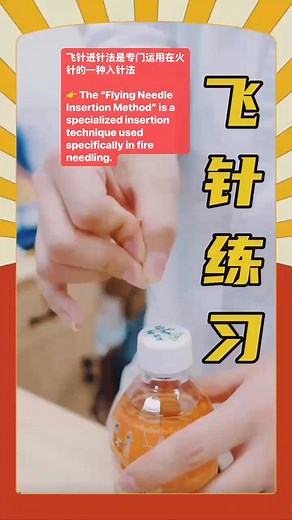 5.3K views · 40 reactions | 飞针进针法是专门运用在火针的一种入针法  The “Flying Needle Insertion Method” is a specialized insertion technique used specifically in fire needling. | Acupuncture Tcm School-Balance Method, Spirit, JiYi Acupuncture Page | Facebook