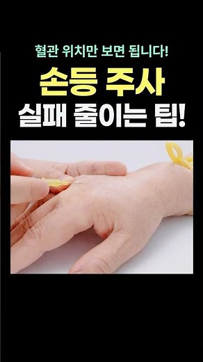 Top 4 Injection Vein Locations on the Back of the Hand #Nurse #BackoftheWrist #IntravenousInjecti...
